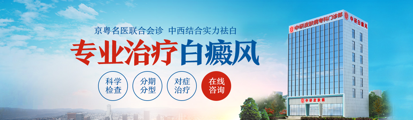 广州白癜风医院